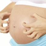 Problemas de la piel durante el embarazo: consejos y prevenciones