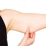 Cómo eliminar la flacidez en los brazos: ejercicios, dieta o cirugía